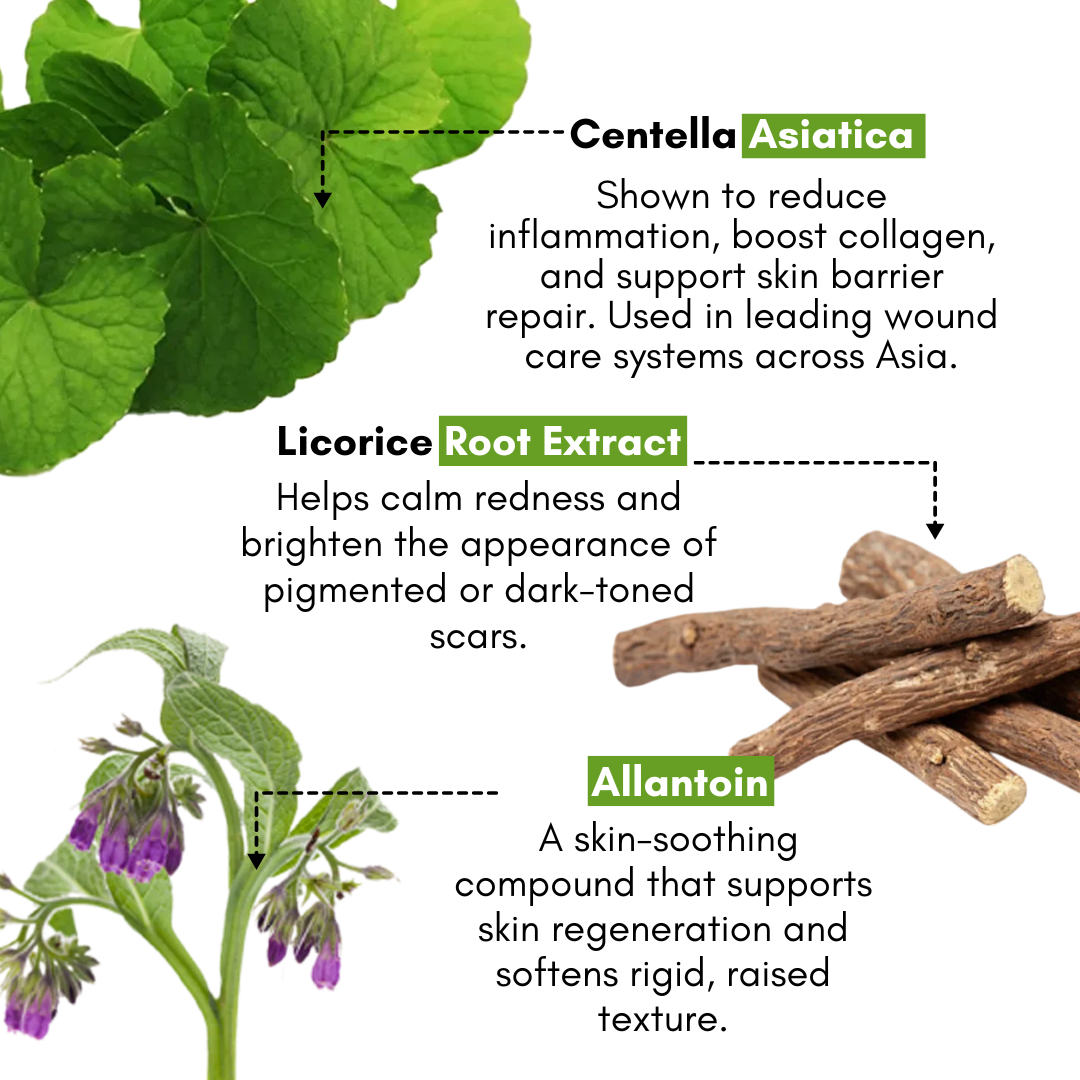 Lauriels Full Scar Rehab Kit